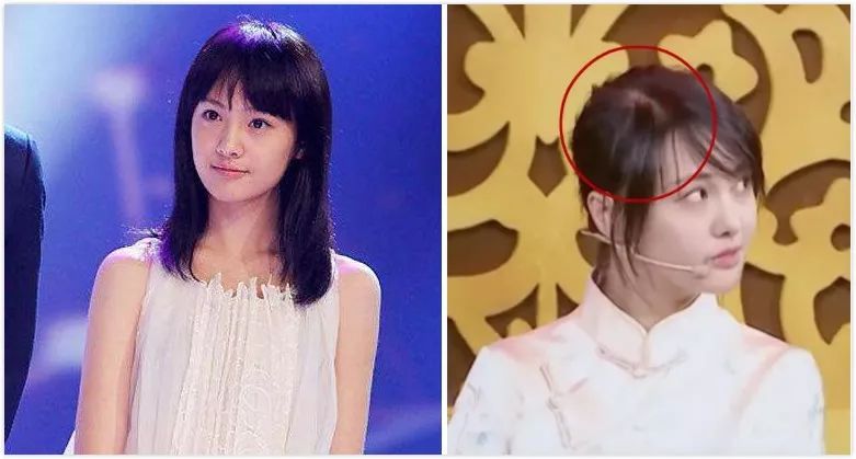 娜扎吃饭中途给自己做高颅顶
