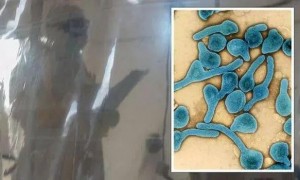 卢旺达马尔堡病毒病疫情已致6人死亡