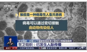 猴痘变异新毒株出现 可飞沫传播