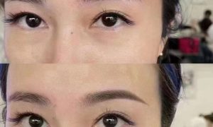 昭阳区轻奢妈生唇选择参考及应用经验分享缩略图